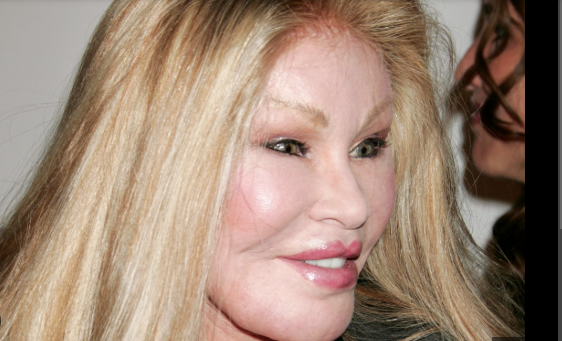 jocelyne wildenstein